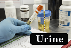 Urine Analysis